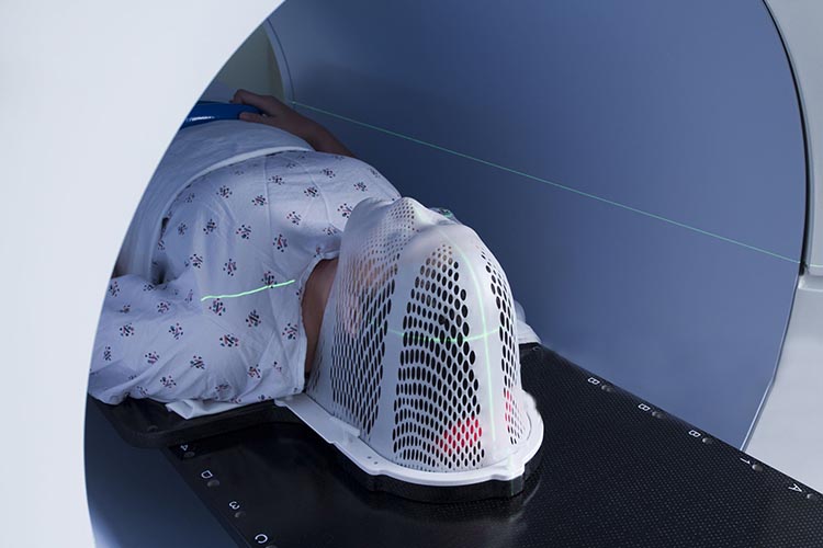 پرتودرمانی در طول چند هفته و معمولاً هر هفته پنج جلسه انجام می‌شود.